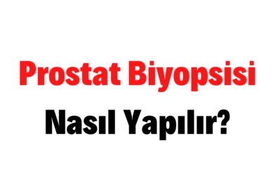 Prostat Biyopsisi Nasıl Yapılır?